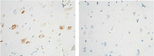 Anti-Human NTRK1 Antibody [B136] - ABMIUM