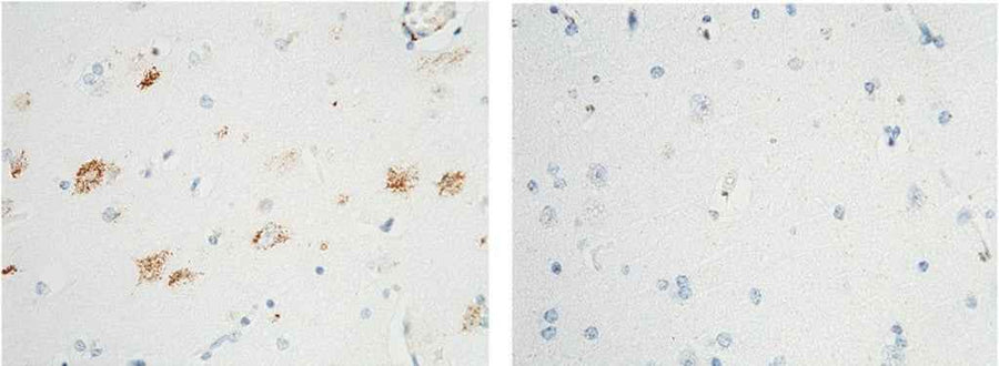 Anti-Human NTRK1 Antibody [B136]