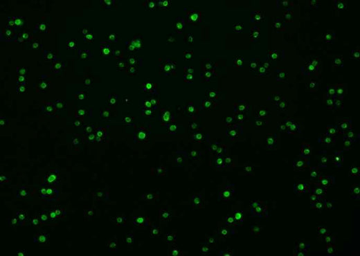 Anti-Mouse SDC4 Antibody [B481] - ABMIUM