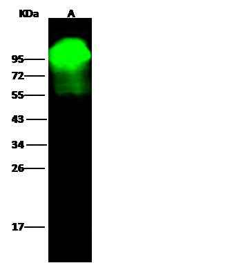 Anti-Human ALPL Antibody [A1203] - ABMIUM
