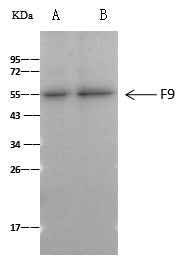Anti-Human F9 Antibody [B152] - ABMIUM