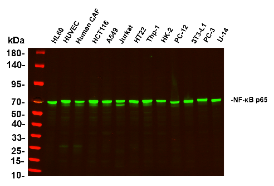 Anti-Human/Mouse/Rat NF-κB p65 Antibody [B1141]