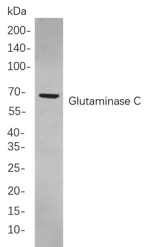 Anti-Human/Mouse/Rat Glutaminase C Antibody [B817] - ABMIUM