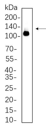Anti-Human/Mouse DDX58 Antibody [B614]