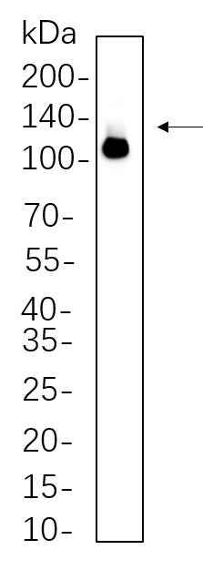 Anti-Human/Mouse DDX58 Antibody [B614] - ABMIUM