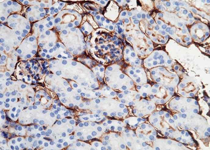Anti-Mouse ICAM1 Antibody [B448] - ABMIUM