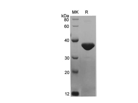SDS-PAGE analysis of Mouse KRT7 proteins, 2 μg/lane of Recombinant Mouse KRT7 proteins was resolved with SDS-PAGE under reducing conditions, showing bands at 36.4 kDa.
