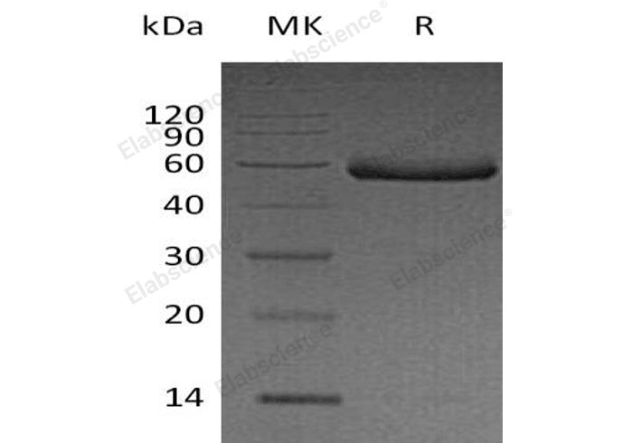 Recombinant Human Fetuin-B/FETUB Protein (His Tag) - ABMIUM