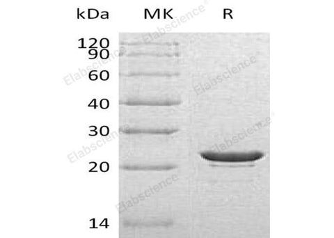 Recombinant Human HSPB8 Protein (His Tag) - ABMIUM