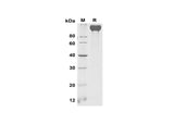 SDS-PAGE analysis of Mouse VEGF R2/Flk-1 proteins, 2 μg/lane of Recombinant Mouse VEGF R2/Flk-1 proteins was resolved with SDS-PAGE under reducing conditions, showing bands at 110-120 kDa.