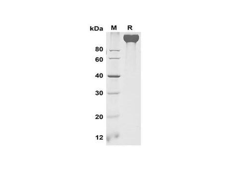 SDS-PAGE analysis of Mouse VEGF R2/Flk-1 proteins, 2 μg/lane of Recombinant Mouse VEGF R2/Flk-1 proteins was resolved with SDS-PAGE under reducing conditions, showing bands at 110-120 kDa.