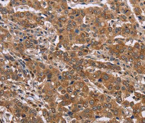 Anti-Human FAAH2 Antibody