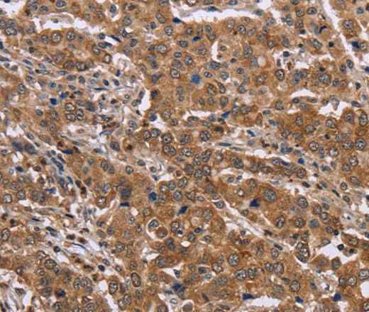 Anti-Human FAAH2 Antibody
