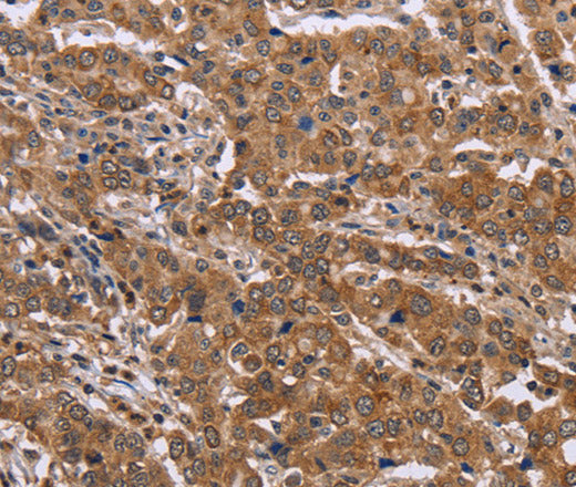 Anti-Human FAAH2 Antibody - ABMIUM