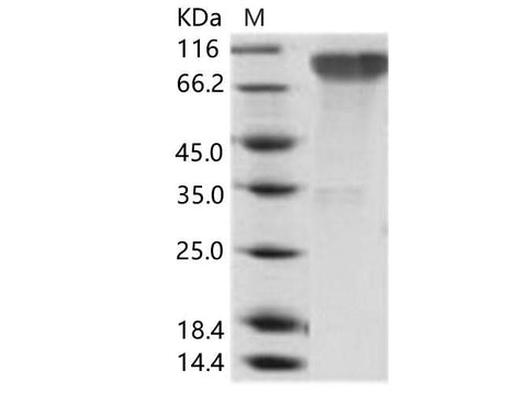 Recombinant Epstein-Barr virus (Herpesvirus 4) EBV Glycoprotein gp350 / EBV GP350 Protein (His Tag) - ABMIUM