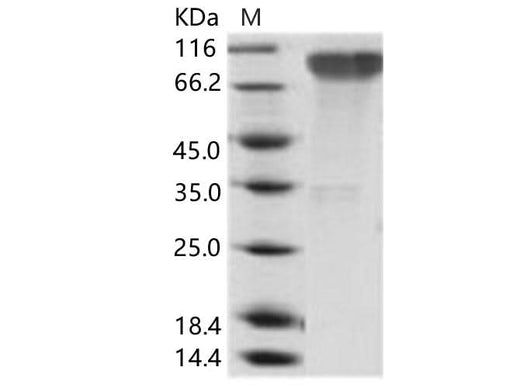 Recombinant Epstein-Barr virus (Herpesvirus 4) EBV Glycoprotein gp350 / EBV GP350 Protein (His Tag) - ABMIUM
