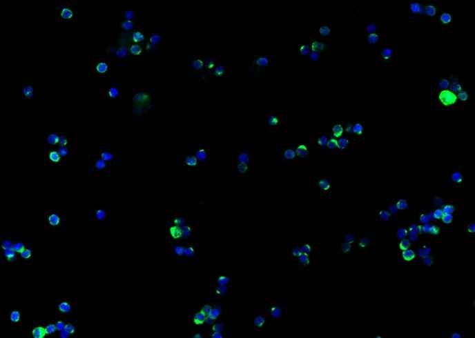 Anti-Mouse IFNG Antibody [B478] - ABMIUM