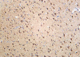 Anti-Human/Mouse/Rat Sortilin Antibody [B925]