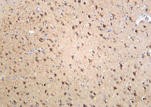 Anti-Human/Mouse/Rat Sortilin Antibody [B925] - ABMIUM