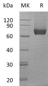 Recombinant Mouse IL7RA/CD127 Protein (Fc Tag) - ABMIUM