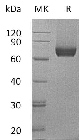 Recombinant Mouse IL7RA/CD127 Protein (Fc Tag) - ABMIUM