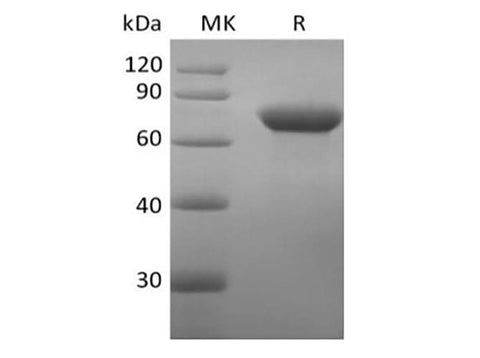 Recombinant Human DC-SIGN/CD209 (N-Fc) - ABMIUM