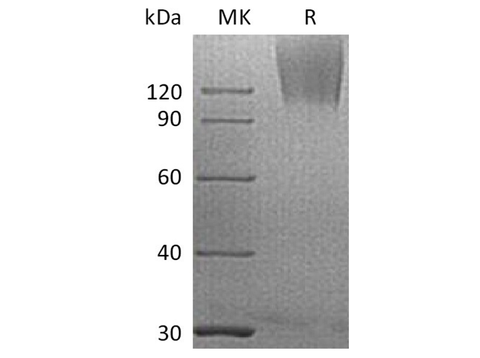 Recombinant Human CEACAM5/CEA Protein (His Tag) - ABMIUM
