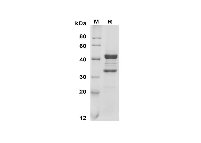 SDS-PAGE analysis of Mouse APRIL/TNFSF13 proteins, 2 μg/lane of Recombinant Mouse APRIL/TNFSF13 proteins was resolved with SDS-PAGE under reducing conditions, showing bands at 42 kDa.