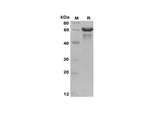 SDS-PAGE analysis of Human GS proteins, 2 μg/lane of Recombinant Human GS proteins was resolved with SDS-PAGE under reducing conditions, showing bands at 60 kDa.