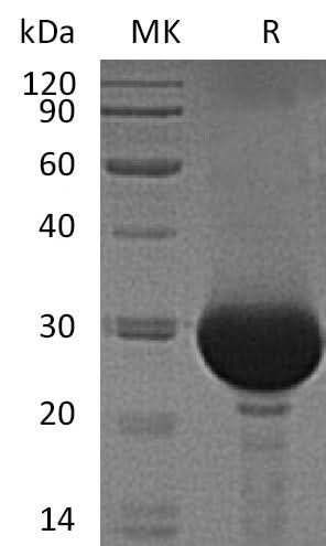 Recombinant Human Carbonic Anhydrase 1/CA1 Protein (His Tag) - ABMIUM