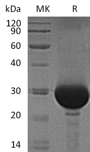 Recombinant Human Carbonic Anhydrase 1/CA1 Protein (His Tag) - ABMIUM