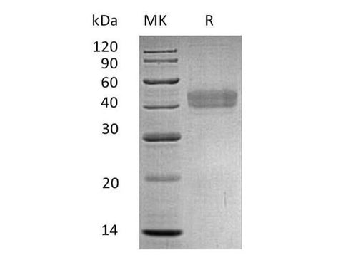 Recombinant Human DKK1/Dkk-1 Protein (His Tag) - ABMIUM