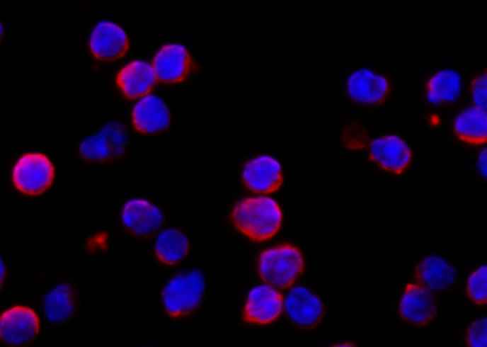Anti-Mouse IFNAR1 Antibody [B452] - ABMIUM