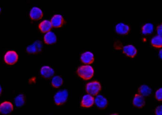 Anti-Mouse IFNAR1 Antibody [B452] - ABMIUM