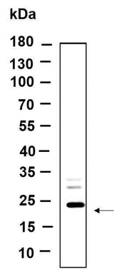 Anti-Human/Mouse/Rat LHFPL5 Antibody [B981]