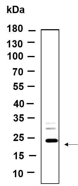 Anti-Human/Mouse/Rat LHFPL5 Antibody [B981] - ABMIUM