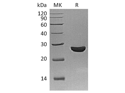 Recombinant Schistosoma Japonicum GST 26 Protein - ABMIUM
