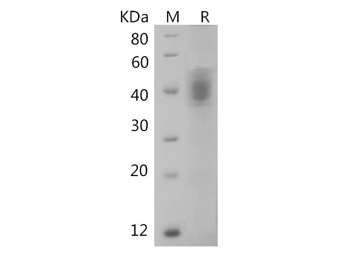 SDS-PAGE analysis of Human IGFBP3 proteins, 2 μg/lane of Recombinant Human IGFBP3 proteins was resolved with SDS-PAGE under reducing conditions, showing bands at 38-42 kDa.