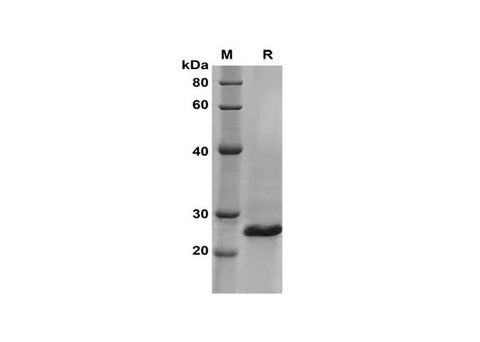 SDS-PAGE analysis of Rat IL-28B/IFN-lambda-3 proteins, 2 μg/lane of Recombinant Rat IL-28B/IFN-lambda-3 proteins was resolved with SDS-PAGE under reducing conditions, showing bands at 26 kDa.