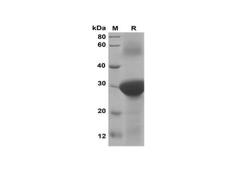 SDS-PAGE analysis of Human CXCL7/NAP-2 proteins, 2 μg/lane of Recombinant Human CXCL7/NAP-2 proteins was resolved with SDS-PAGE under reducing conditions, showing bands at 30 kDa.