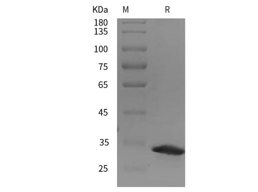 SDS-PAGE analysis of Rat ST14/Matriptase proteins, 2 μg/lane of Recombinant Rat ST14/Matriptase proteins was resolved with SDS-PAGE under reducing conditions, showing bands at 34 kDa.