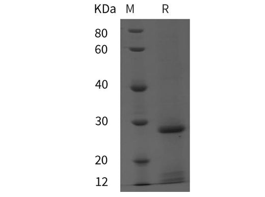 SDS-PAGE analysis of Rat PRL proteins, 2 μg/lane of Recombinant Rat PRL proteins was resolved with SDS-PAGE under reducing conditions, showing bands at 28 kDa.