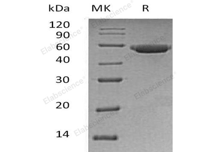Recombinant Human Gastric Lipase/LIPF Protein (Human Cells, His Tag) - ABMIUM