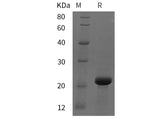 SDS-PAGE analysis of Mouse BRAF35 proteins, 2 μg/lane of Recombinant Mouse BRAF35 proteins was resolved with SDS-PAGE under reducing conditions, showing bands at 22 kDa.