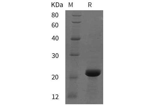 SDS-PAGE analysis of Mouse BRAF35 proteins, 2 μg/lane of Recombinant Mouse BRAF35 proteins was resolved with SDS-PAGE under reducing conditions, showing bands at 22 kDa.