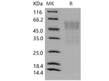 > 80 % as determined by reducing SDS-PAGE.