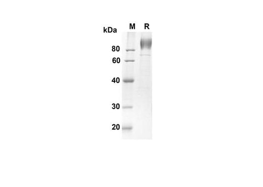 SDS-PAGE analysis of Human IL6ST proteins, 2 μg/lane of Recombinant Human IL6ST proteins was resolved with an SDS-PAGE under reducing conditions, showing bands at 65.5 kDa.