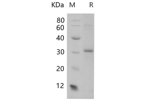 SDS-PAGE analysis of Mouse ADIPOQ proteins, 2 μg/lane of Recombinant Mouse ADIPOQ proteins was resolved with SDS-PAGE under reducing conditions, showing bands at 27.22 kDa.