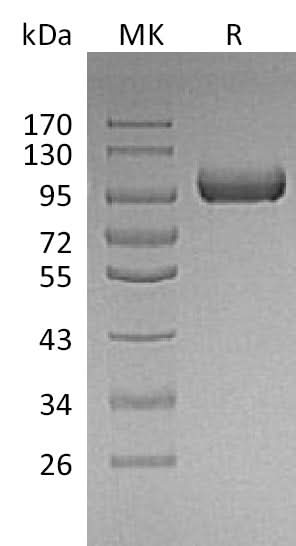 Recombinant Mouse LRIG1 Protein (His Tag) - ABMIUM