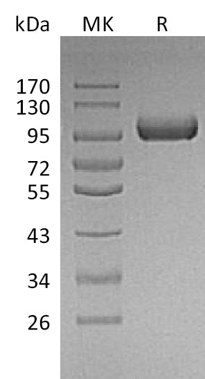 Recombinant Mouse LRIG1 Protein (His Tag) - ABMIUM
